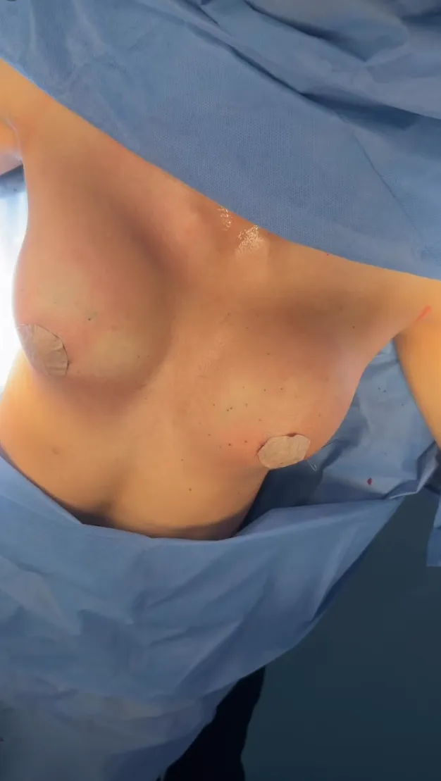 Después - Transformación